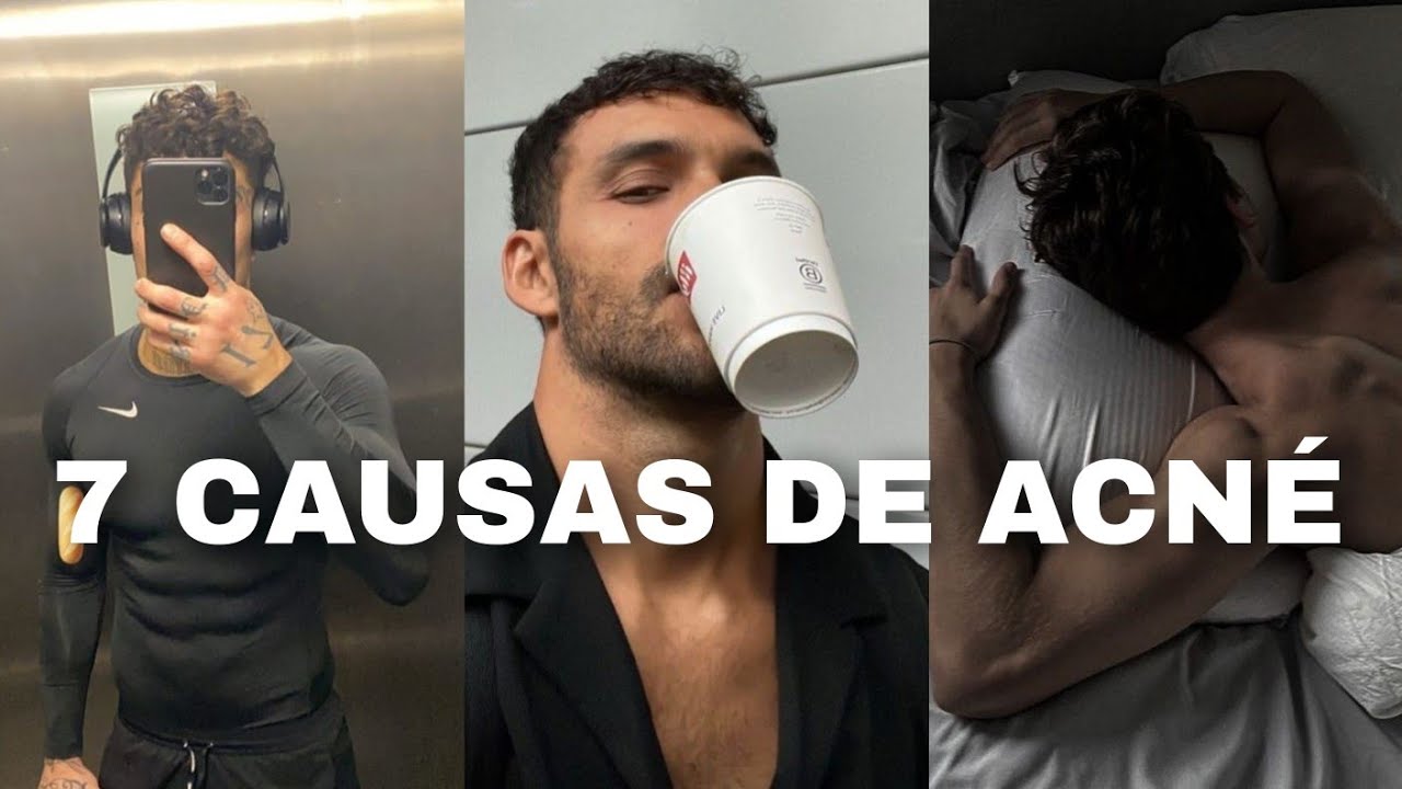 Cómo mejorar la forma de tu cara destacando 7 causas del acné